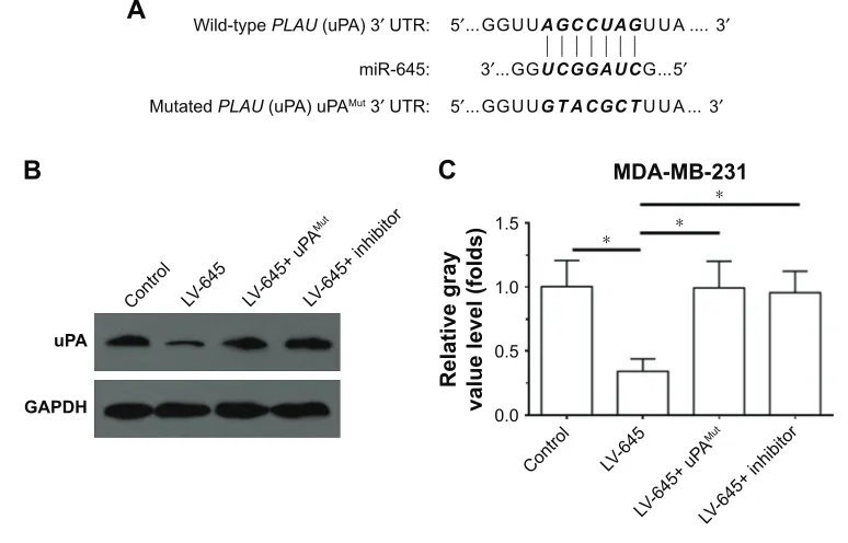 Figure 1 The expression of uPa in breast cancer cells.Notes: Breast cancer cells McF-7, Zr75-1, BT474, sK-Br3 and MDa-MB-231 were cultured and harvested for western blot experiments