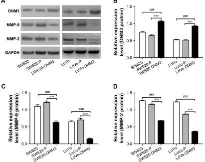 Figure 3 SW620 and LoVo cell growth curves. Compared with the control groups, DNM3 overexpression significantly inhibited cell proliferation.Notes: (A) SW620 cell growth curves