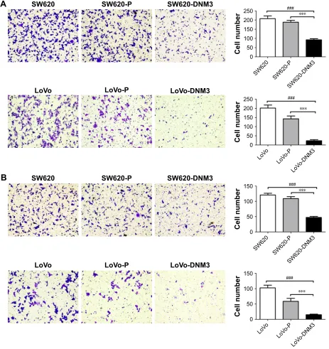 Figure 4 Microscopic pictures of transwell migration and invasion assay.Notes: (A) Migration assay, DNM3 overexpression groups significantly decreased the ability of migration