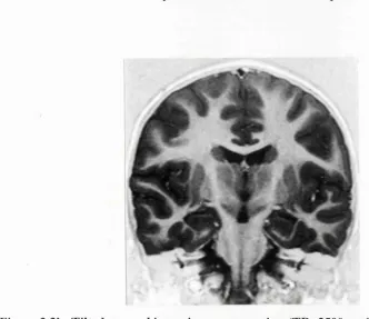 Figure 3.3: Optimised magnetic resonance imaging