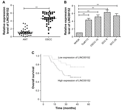 Figure 1 linc00152 is overexpressed in Oscc samples and is associated with reduced survival of patients with Oscc.Notes: (A) relative expression of linc00152 in Oscc tissues (n=40) and in paired adjacent normal tissues (n=40)