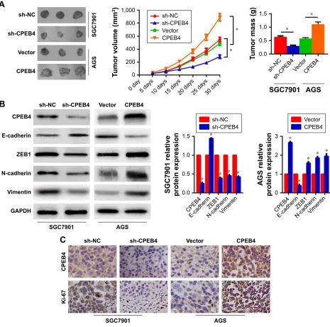 Figure 5 Influences of CPEB4 silencing or overexpression on GC cells’ tumor growth in vivo.Notes: (A) representative images of tumors formed in nude mice injected subcutaneously with gc cells