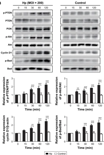 Figure 6 Helicobacter pylori infection induces PlK1-mediated activation of the Pi3K/akt pathway in a time-dependent manner