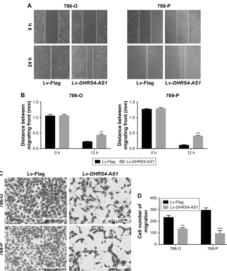 Figure 6 exogenetic DHRS4-AS1 expression suppresses ccrcc cell migration.Notes: (A and B) in vitro wound-healing analysis in negative control, Flag or DHRS4-AS1 cells