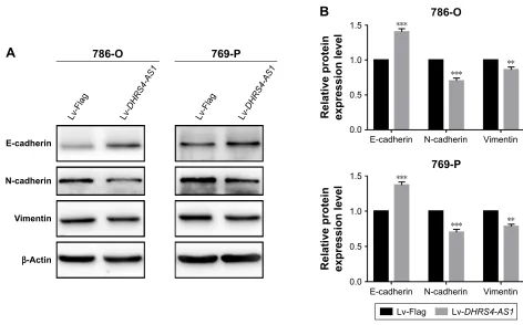 Figure 7 DHRS4-AS1 controls the expression of eMT-associated genes in ccrcc cells.Notes: (A and B) The expression levels of e-cadherin, n-cadherin and Vimentin in 786-O and 769-P cells were measured by using Western blot analysis