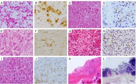 Figure 2. Immunohistochemical and pathological detection of bacteria and fungi in formalin-fixed paraffin-embed-ded (FFPE) samples