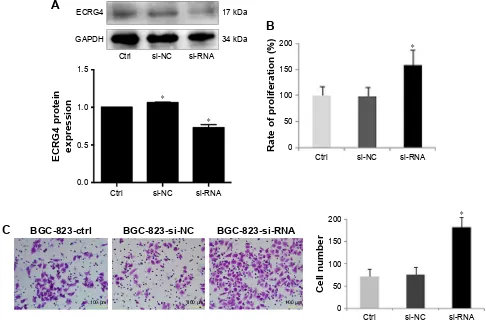 Figure 2 ECRG4-specific small interfering RNAs (siRNAs) promote the proliferation and invasion of gastric cancer (GC) cells
