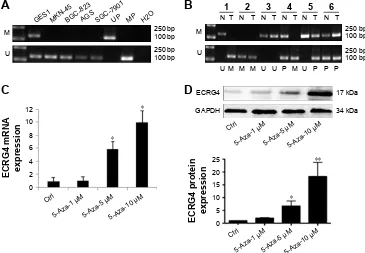 Figure 3 effects of ecrg4 expression on the cell cycle of gastric cancer (gc) cells. (A) control; (B) pcDna3.1; (C) pcDna3.1-ecrg4; (D) sirna-nc; (E) sirna-ecrg4
