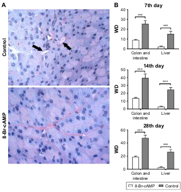 Figure 2 Formation of VM between 8-Br-caMP-treated group and control group.Notes: (A) Pas–cD31 staining of sections of colorectal and intestinal tumors from control and experimental groups