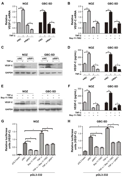 Figure 4 riP1 regulates TnF-**Abbreviations:α-mediated VegF-c expression through the nF-κB pathway.Notes: (A, C, D) The VegF-c mrna and protein in the sinc and siriP1 cell groups were extracted and examined via qPcr, Western blotting, and elisa afterbeing 