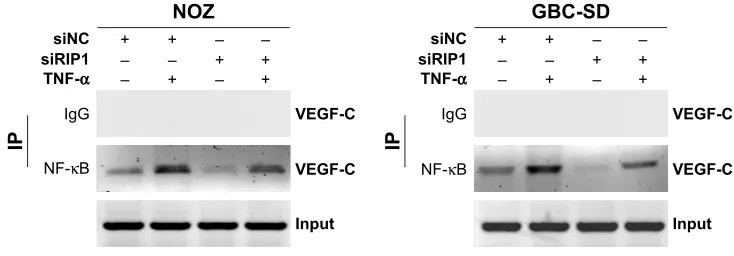 Figure 5 Knockdown of riP1 impaired the TnF-α-enhanced association of nF-κB with the VegF-c promoter region.Notes: chromatin was extracted from the sinc and siriP1 cell groups and sheared after the cells were stimulated with 50 ng/ml of recombinant human T