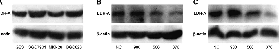 Figure 1 sirna targeting lDh-a reduces the expression of lDh-a in sgc7901 and Bgc823 cells.Notes: (A) expression of lDh-a in ges and three iTgc cell lines was determined by Western blot analysis