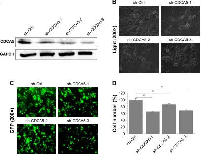 Figure 2 high expression of cDca5 indicates poor survival in patients with hcc. Notes: (A) Overall survival outcomes of patients with hcc were analyzed using log-rank tests based on cDca5 expression in hcc tissues from the Tcga cohort