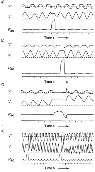 Figure 3.5: Potential problems with the multiple occlusion technique