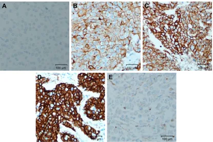 Figure 1 histogram depicting proportion of breast carcinomas with different staining intensities of indicated Wnt signaling pathway molecules.Abbreviations: aPc, adenomatous polyposis coli; DKK3, Dickkopf Wnt signaling pathway inhibitor 3; FrP2, frizzled related protein 2; WiF1, Wnt inhibitory factor-1.