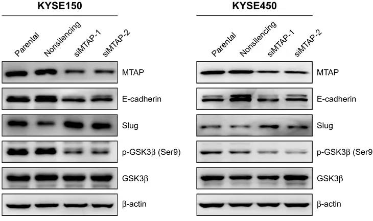 Figure 4 MTaP knockdown regulated the expression of proteins related with cell motility in escc.Note: after MTaP knockdown in KYse150 and KYse450 cells, e-cadherin and p-gsK3β were downregulated, whereas slug was upregulated.Abbreviations: siMTAP, MTAP-specific siRNA; ESCC, esophageal squamous cell carcinoma.
