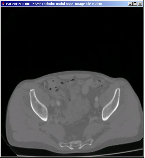 Fig 7. Screenshot of GUI patient’s data 