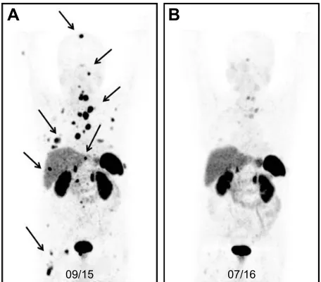 Figure 4A shows the pre-therapeutic [68(first and second line), enzalutamide, and abiraterone