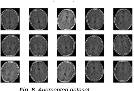 Tabel 1. Accuracy,Precision,Sensitivity,Specificity values 