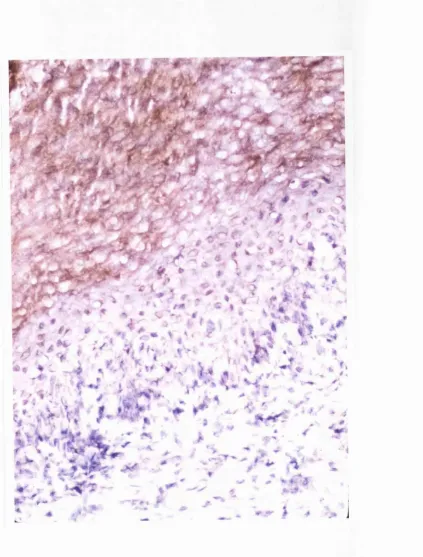 Figure 2.9: Expression of putative HCV antigens in oral lichen planus lesional 