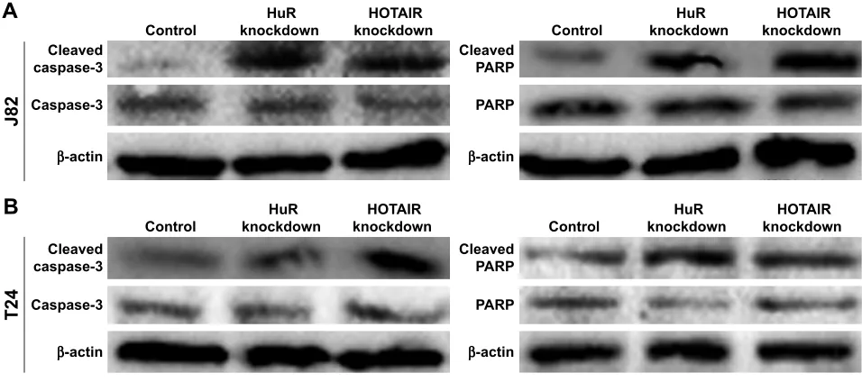 Figure S1 The effects of hOTair/hur knockdown on cleaved-caspase-3 and ParP.Note: (A and B) The cleaved-caspase-3 and cleaved-ParP levels were evaluated in J82 and T24 cells with hur/hOTair knockdown.Abbreviations: hOTair, hOX transcript antisense rna; ParP, poly aDP-ribose polymerase.