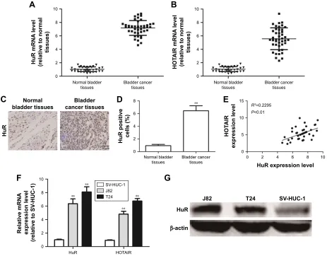 Figure 1 The association between hur and hOTair expression levels in clinical samples.Notes: (A and B) The mrna levels of hur and hOTair were examined in 43 Tcc tissues and 36 normal bladder tissues