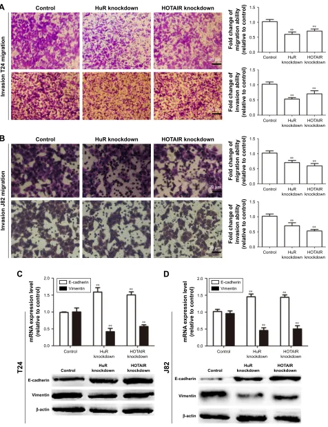Figure 3 The effects of hOTair and hur on Tcc cell migration and invasion in vitro.Notes: (A and B) Knockdown of hur and hOTair inhibited cell migration in J82 and T24 cells