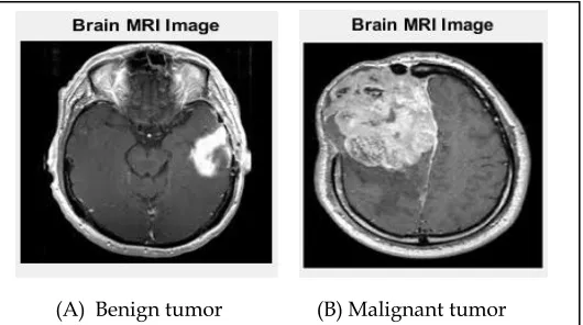 Fig. 2. Images of all kinds of tumors from the dataset 