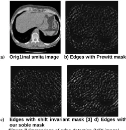 Figure 7our soble mask  Comparison of edge detection (MRI image) 