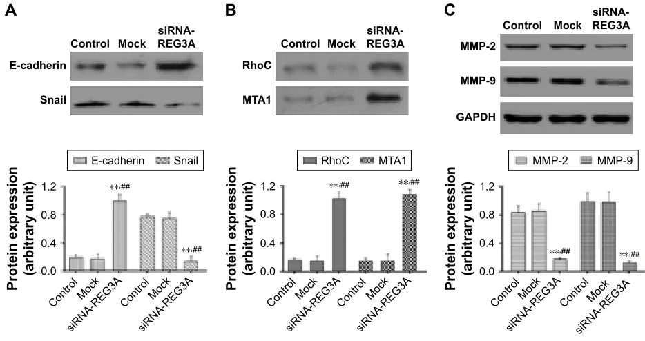 Figure 5 reg3a regulated the expression of multiple cancer-related genes.Notes: The protein levels of e-cadherin (A), rhoc and MTa1 (B) were significantly increased, while those of Snail (A), MMP-2 and MMP-9 (C) were significantly decreased in sgc-7901 cel
