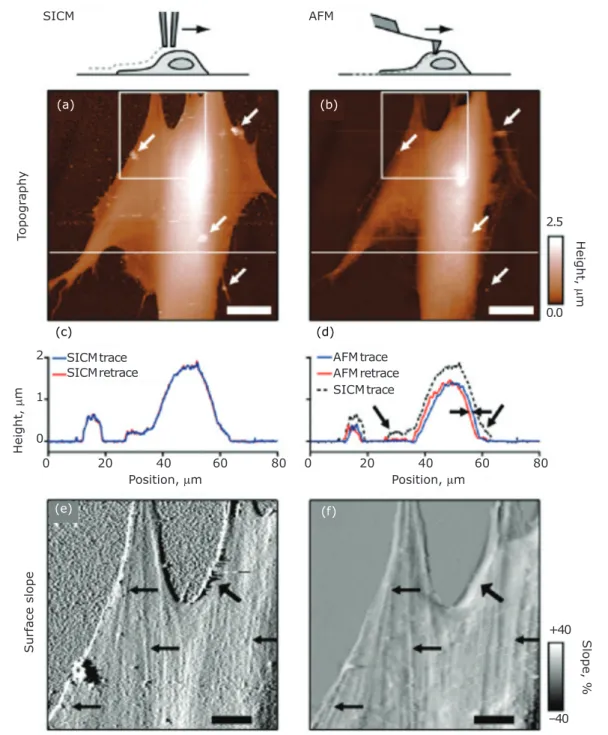 Fig. 8. Comparison of images of the same fixed fibroblast cell taken using: (a) SICM; and (b) tapping mode  AFM