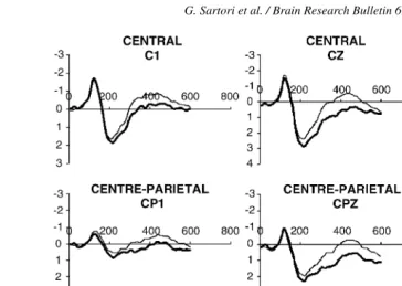Fig. 2. ERPs for high (thick line) and low (thin line) relevance items. In the x-axis time is represented (ms), in the y-axis amplitude is represented (�V)
