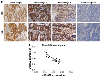 Figure 1 elevated expression of mir-622 but depressed DYrK2 in colorectal cancer tissue and cell lines