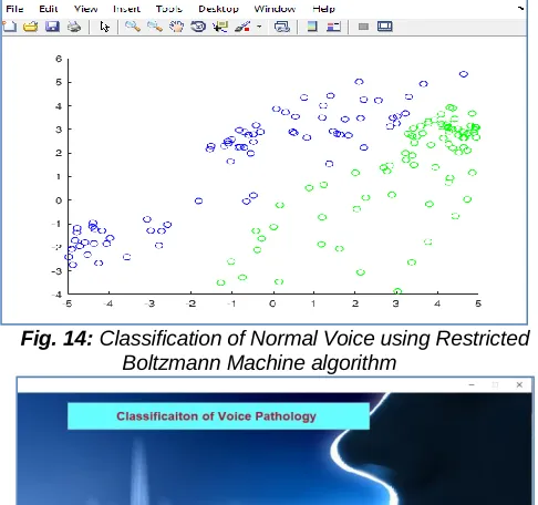 Fig. 14:  Classification of Normal Voice using Restricted Boltzmann Machine algorithm 