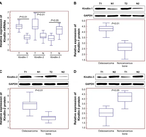 Figure 1 Kindlin gene and protein expression levels in human osteosarcoma tissues.Notes: (A) Kindlin-1 and Kindlin-2 mRNA levels in osteosarcoma tissues were both significantly higher than those in adjacent noncancerous tissues (both P,0.01), whereas Kindl