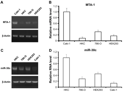 Figure 2 expression of mir-30c is inversely associated with MTa-1 in kidney or ccrcc cell lines.Notes: The expression of MTa-1 (A, B) or mir-30c (C, D) in kidney nontumor cell lines hKc or heK293, and ccrcc cell lines caki-1 or 786-O was detected by quanti