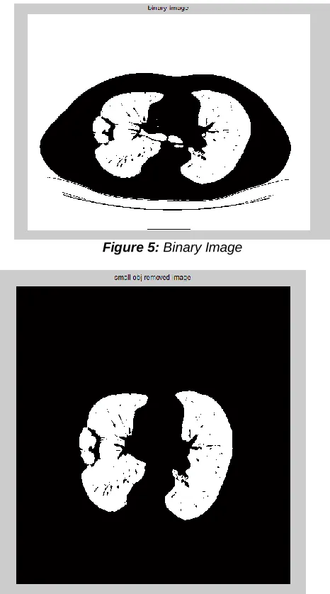 Figure 5: Binary Image 