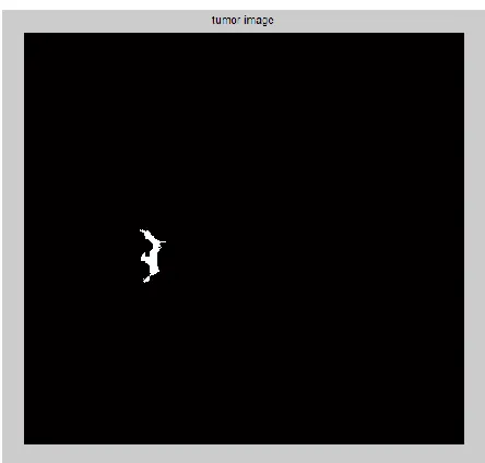 Figure 8: Lung Image-Shape  