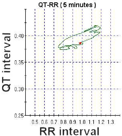 Figure 3. QT interval hysteresis versus RR dynamic relationship. 