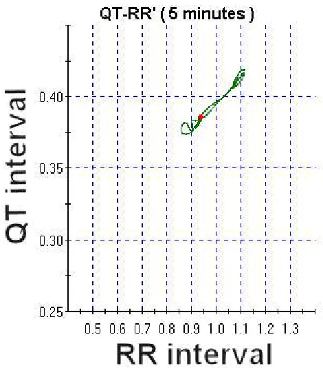 Figure 4. Compensation of QT lag using the same dataset as presented in Figure 3. See text for detailed explanations