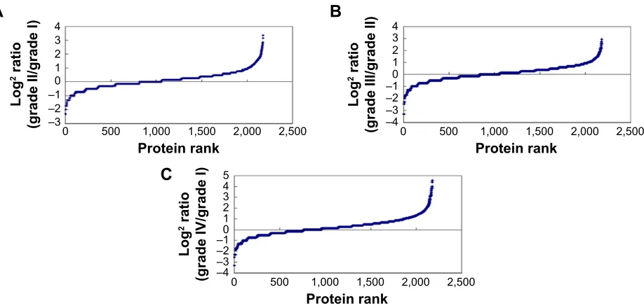 Table 1 number of upregulated proteins and downregulated proteins in different grades of astrocytomas analyzed by lc-Ms/Ms
