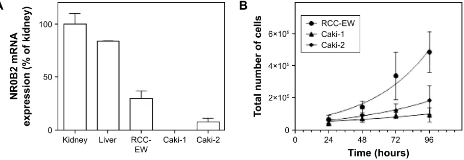 Figure 2 characterization of nr0B2 expression human renal carcinoma cell lines.Notes: (A) nr0B2 mrna expression assessed by TaqMan® quantitative rT-Pcr