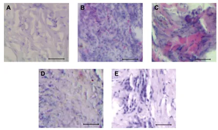 Figure 1 histological characteristics of normal and osteosarcoma tissues.Notes: (A) histological section of normal bone tissue of a mouse showing uniform arrangement of cells
