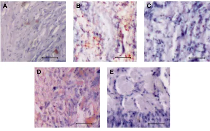 Figure 2 analysis of sox2 expression in normal and osteosarcoma tissues.Notes: (A) sox2 expression in normal bone tissue of a mouse