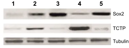 Figure 4 Western blotting analysis of sox2 and TcTP expression.Notes: The protein samples were prepared from saM-treated osteosarcoma tissue along with various controls and subjected to Western blotting analysis and then stained with anti-sox2 antibody and