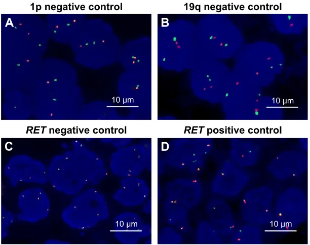 Figure S1 (A) 1p negative control; (B) 19q negative control; (C) RET negative control; (D) RET positive control.