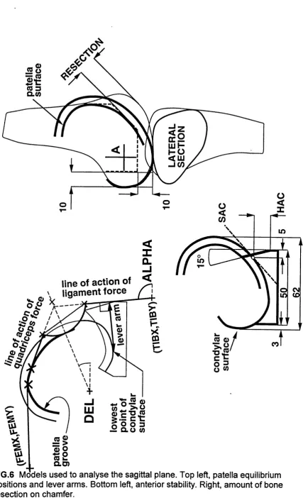 FIG .6 Models used to analyse the sagittal plane. Top left, patella equilibrium 