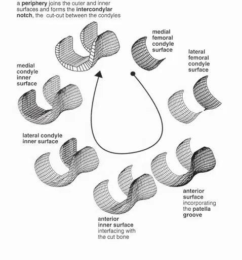 FIG. 1 The different regions which make up the femoral component.