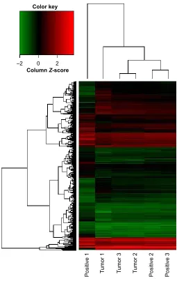 Figure S1 a heat map showing differentially expressed lncrnas from tumor tissues compared with Mlns.Notes: each row represents one lncrna, and each column represents one sample