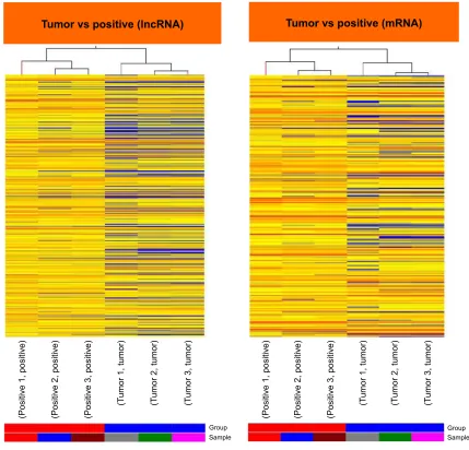 Figure 1 hierarchical clustering for differentially expressed lncrnas and mrnas in tumor vs Mln (positive).Notes: “red” indicates high relative expression, and “blue” indicates low relative expression